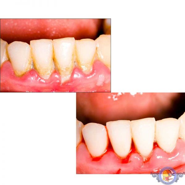 خمیر دندان اورال بی مدل Tartar حجم 100 میل