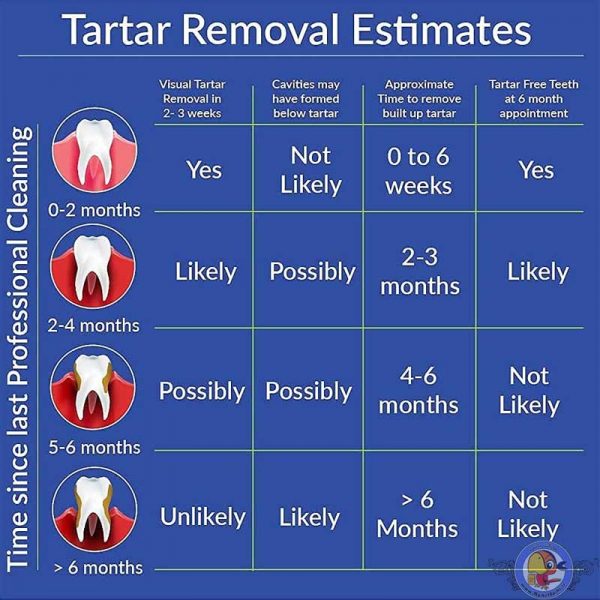خمیر دندان اورال بی مدل Tartar حجم 100 میل