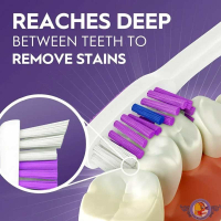 مسواک اورال-بی 3D White مدل White Fresh برس مدیوم – ساخت ایرلند